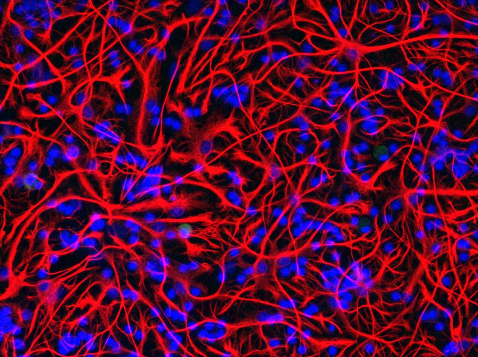 Astrocytes. Photo: courtesy of  Dr. Silvija Jankeviciute.