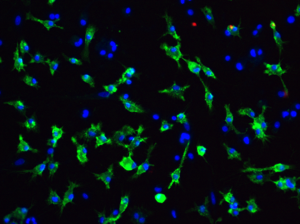 Synaptic networks. Photo: courtesy of  Dr. Silvija Jankeviciute.