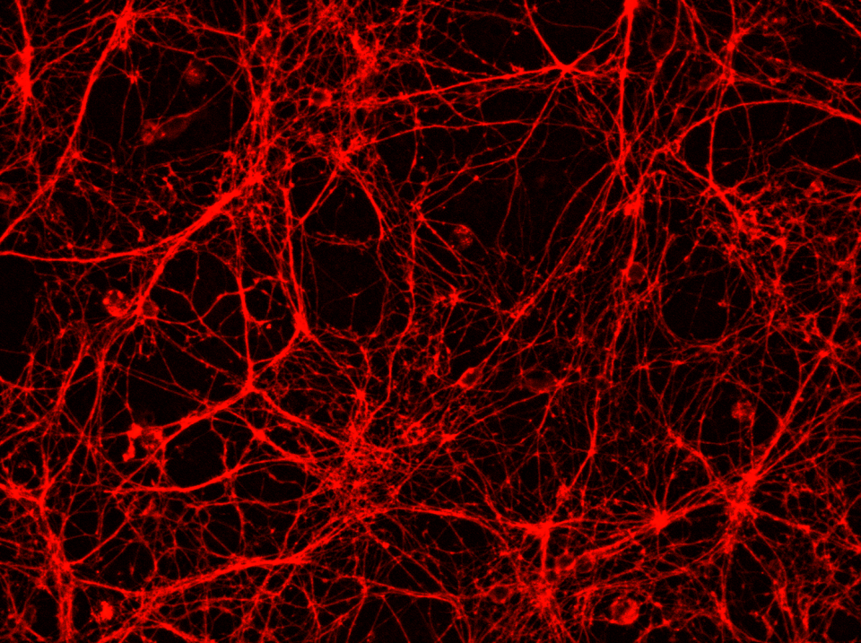 Synaptic networks. Photo: courtesy of  Dr. Silvija Jankeviciute.